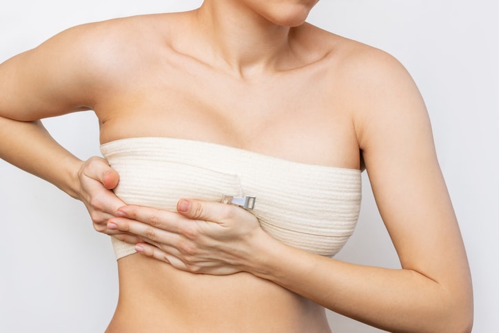 Breast augmentation