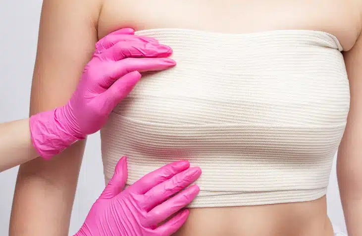 Breast augmentation