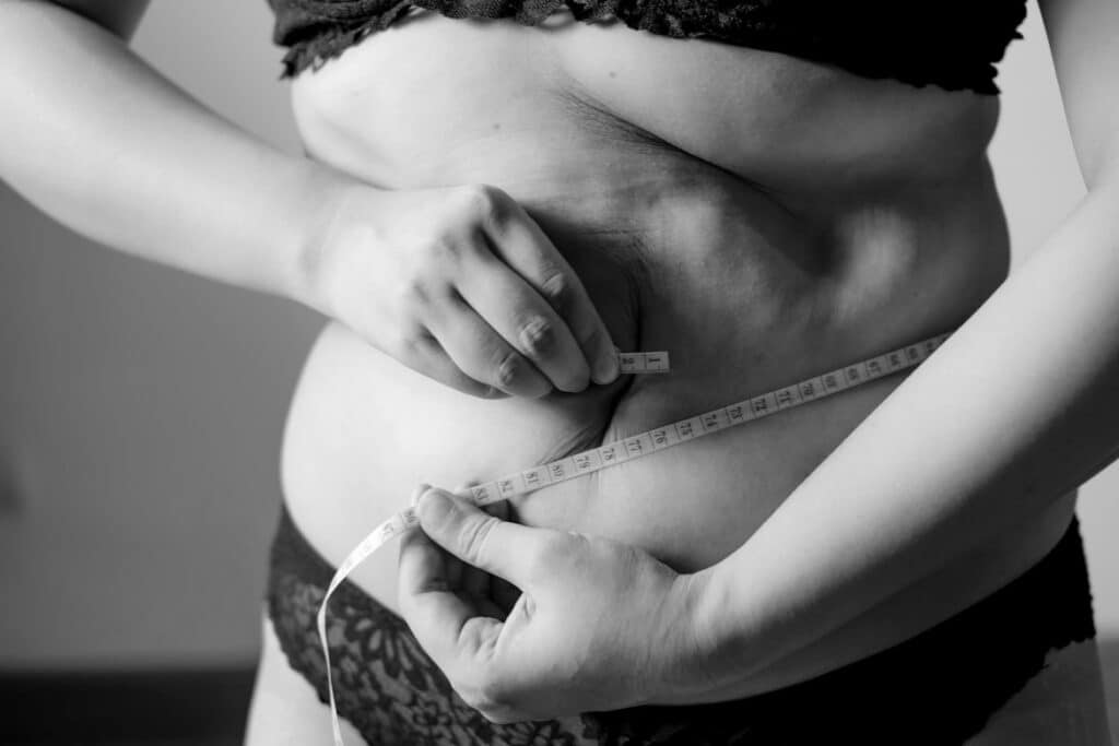 Understanding metabolic and bariatric surgery options in mt. Clemens - physique by pesta Image 4 - physique by pesta